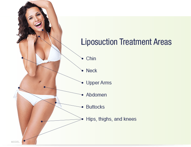 Liposuction Areas