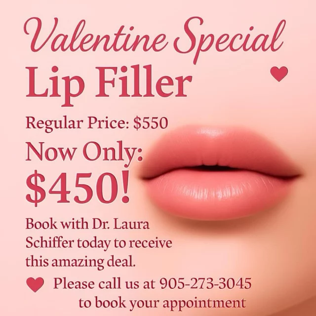 💖 Valentine’s Lip Filler Special! 💖

This Valentine’s Day, treat yourself to fuller, luscious lips! For a limited time, our regular lip filler price of $550 is now just $450!

✨ Book your appointment with Dr. Schiffer and take advantage of this amazing deal.

Don’t miss out on this opportunity to enhance your smile just in time for Valentine’s Day!

📞 Call us today at 905 273 3045 to schedule your appointment!

#lusciuuslips #valentines #lipfillers #💗