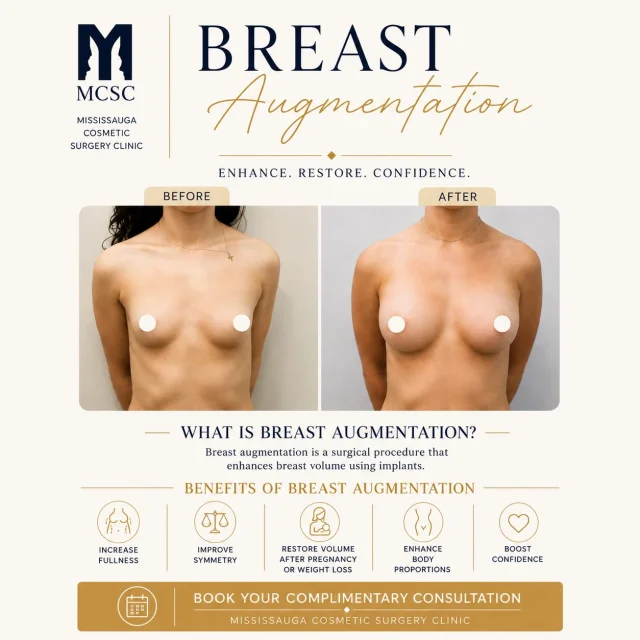 BREAST AUGMENTATION

Before & After

Enhance Your Natural Shape

Breast augmentation is a surgical procedure designed to increase breast volume and improve overall shape using implants tailored to your goals.

✓ Increase fullness
✓ Improve symmetry
✓ Restore lost volume
✓ Enhance confidence

Book Your Complimentary Consultation 905-273-3045
#breastsugmentation #surgeryjourney #beforeandafter #consultation #breastimplants